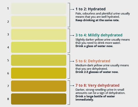 Kidney stones and dehydation